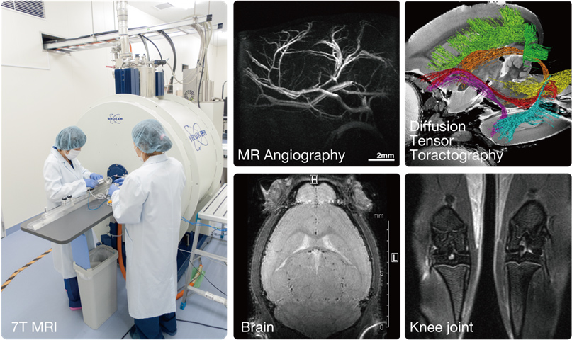 Magnetic Resonance Imaging (MRI)