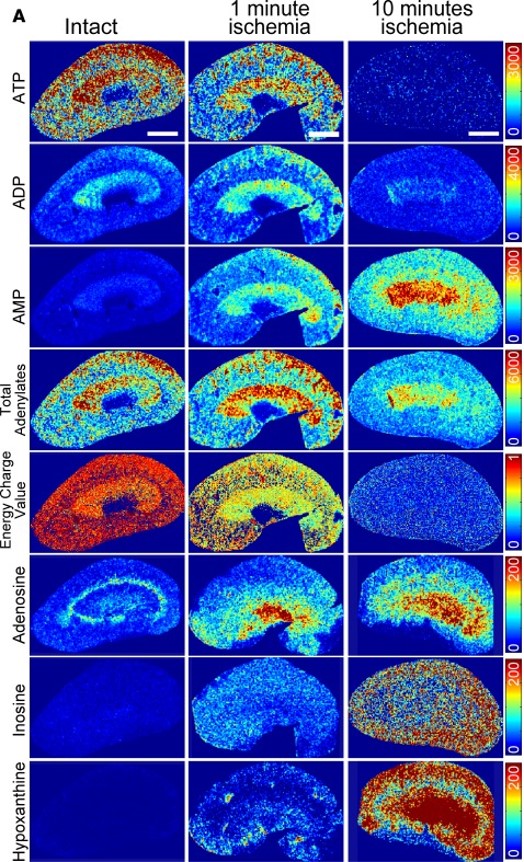 Semiquantitative mass spectrometric images